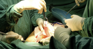 Inselspital: Nach gewissen Operationen zu viele Komplikationen